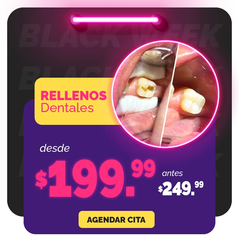 Rellenos dentales desde $199.99, antes $249.99. ¡Recibe atención de calidad a precios más bajos!